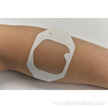 IV CANNULA Transparante filmverband 6 * 7cm voor wondverzorging